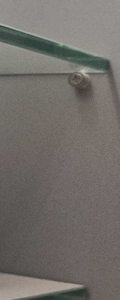 어르신 임플란트 지원 현명하게 활용하려면 관련 이미지 31