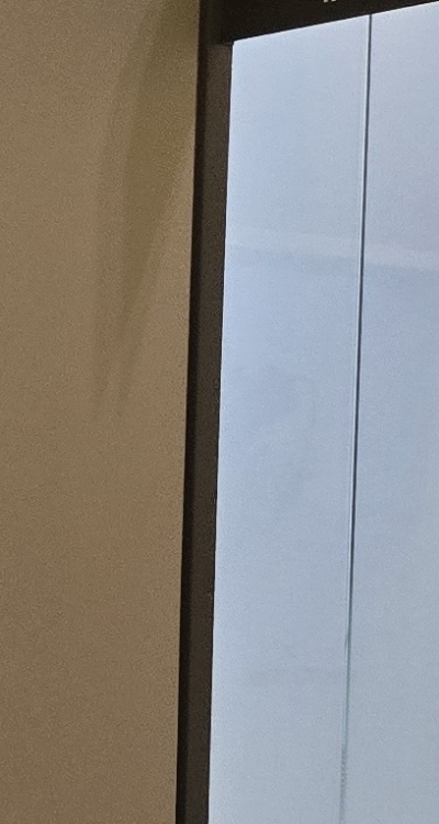 사랑니 발치 후 충치 치료 둘다 준비하려면 관련 이미지 29