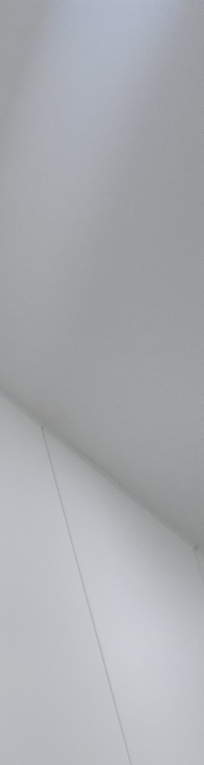 앞니 크라운 교체 깔끔하게 정리하려면 관련 이미지 18