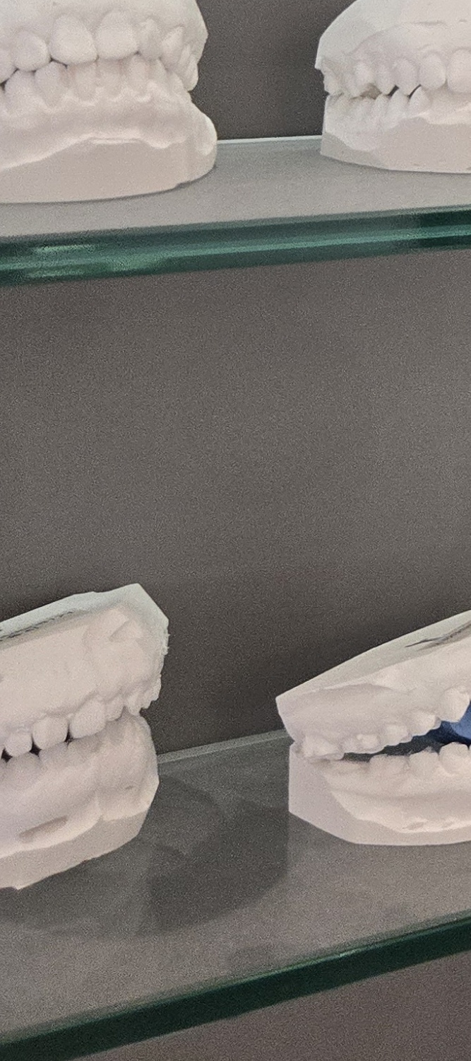 앞니 틀어짐 교정 이렇게 파악하세요 관련 이미지 17