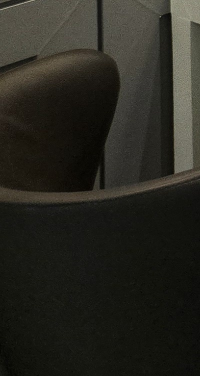 아래 사랑니 발치 통증 미리 알고 대처하려면 관련 이미지 39