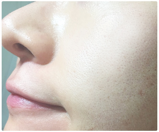 필링패드추천 지성은 다 드루와 관련 이미지 12