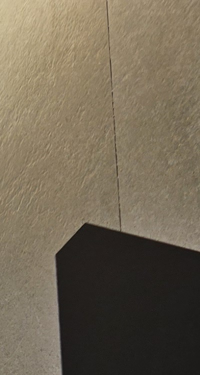 반대교합 치아교정 해결 가능할까 관련 이미지 14