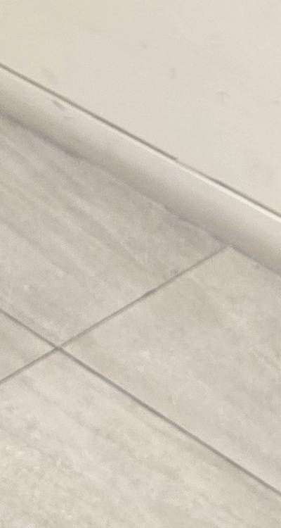 송곳니 크라운 티가 안나게 해결 가능한건가요 관련 이미지 42