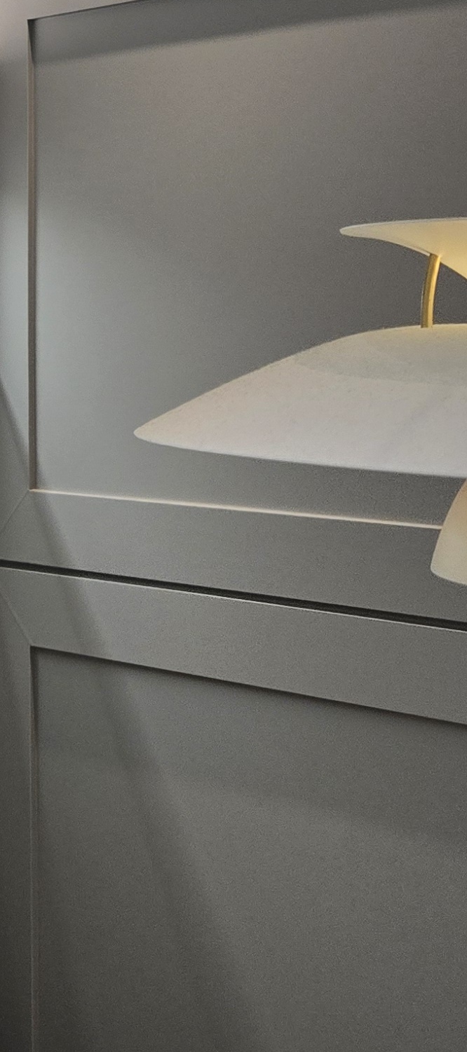 어금니 임플란트 뼈이식 이럴때 해당됩니다 관련 이미지 30