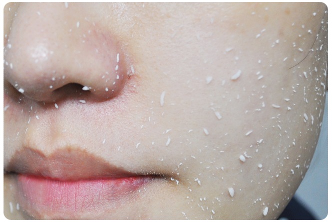 얼굴필링! 가을철얼굴각질제거에는 이게 특효죠 관련 이미지 6