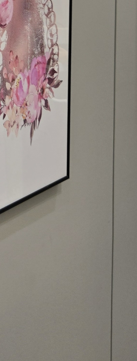 비발치 돌출입 교정 어떨때 적절할까 관련 이미지 33