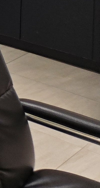 돌출입 팔자주름 교정 얼마나 바뀔까요 관련 이미지 51