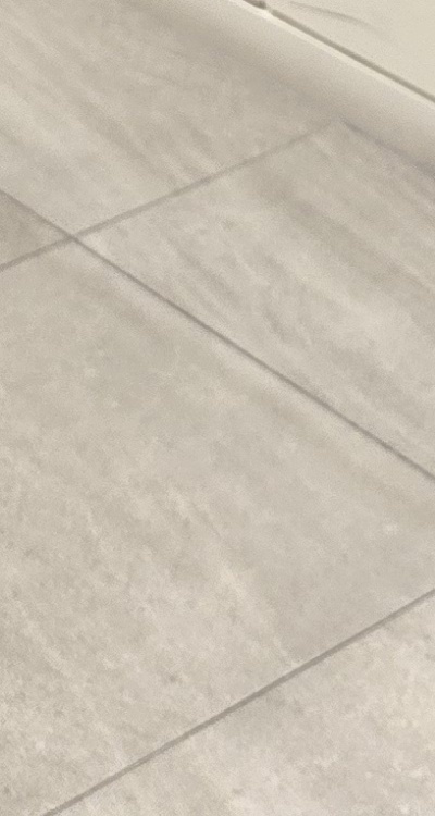 송곳니 크라운 티가 안나게 해결 가능한건가요 관련 이미지 41