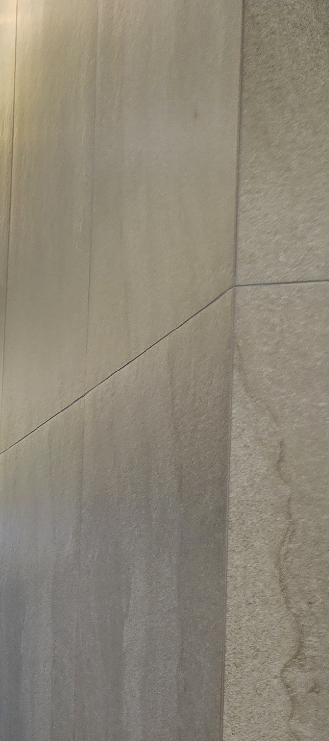 앞니 틀어짐 교정 방법 이럴때는 좀더 간단해요 관련 이미지 26