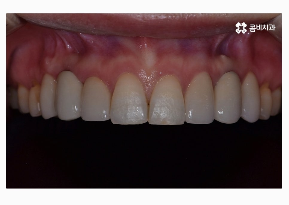 30대임플란트 향후 미래를 바라본다면 관련 이미지 13