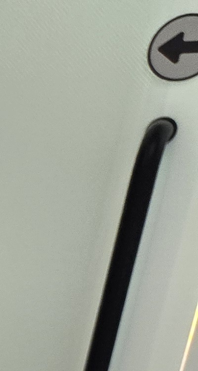 신경치료 아픈가요 망설이시는 분들이라면 관련 이미지 20