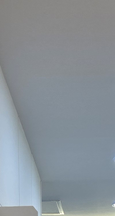 클리피씨교정 장단점 어떻게 비교하면 될까요 관련 이미지 14