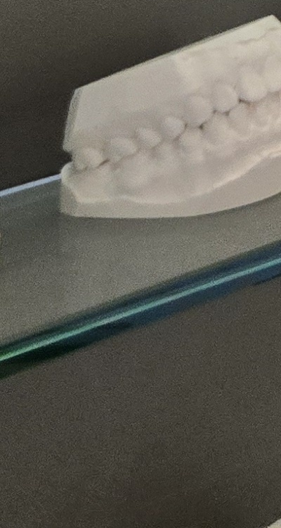 완전매복사랑니 발치 대학병원 꼭 가야하나요 관련 이미지 41