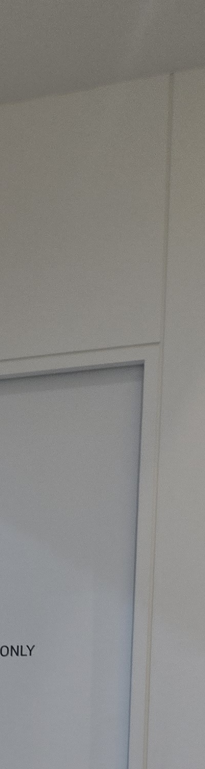 어금니 없으면 얼굴 발음에 어느정도나 안좋을까 관련 이미지 23