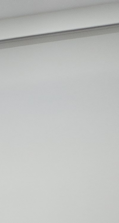 50대임플란트 꼼꼼하게 따져봐야할 포인트는 관련 이미지 20