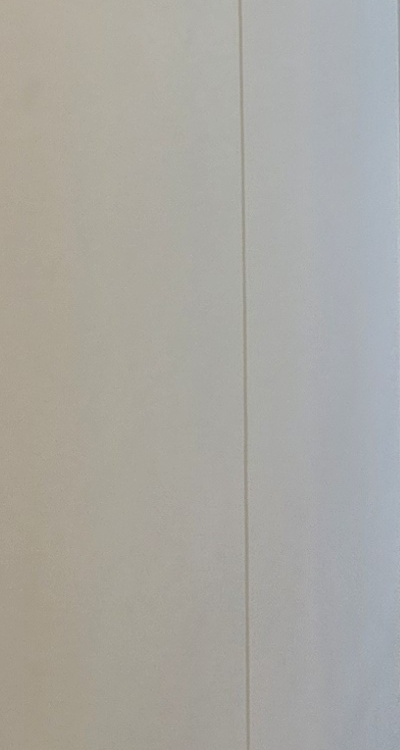 클리피씨교정 장단점 어떻게 비교하면 될까요 관련 이미지 33