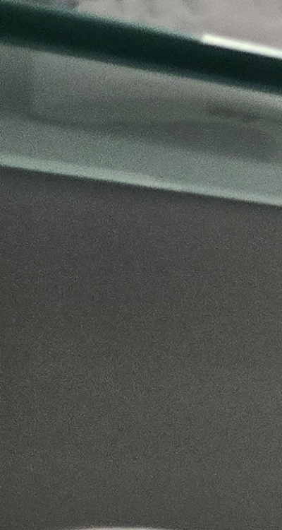 완전매복사랑니 발치 대학병원 꼭 가야하나요 관련 이미지 19