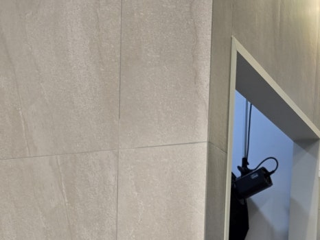 65세이상 임플란트 개수 구체적으로 체크하려면 관련 이미지 20