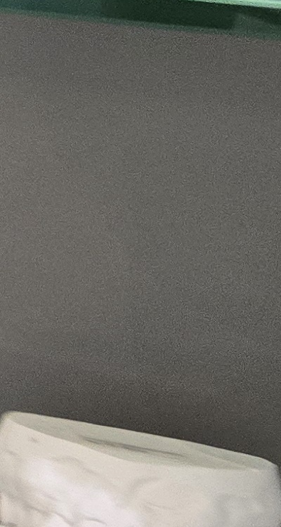 윗니 전체 임플란트 뭐부터 해야할까 관련 이미지 37