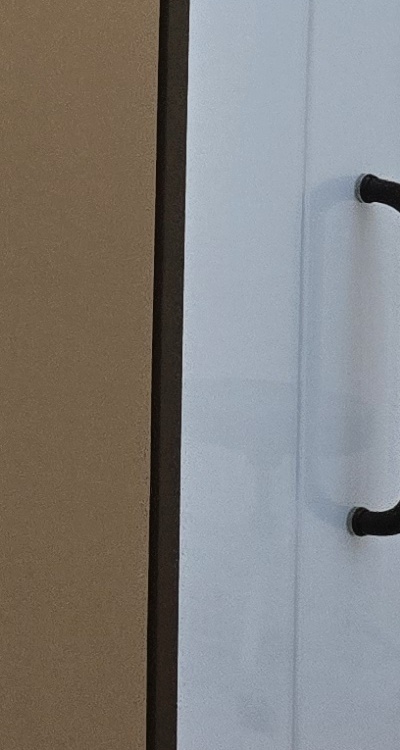 사랑니 발치 후 충치 치료 둘다 준비하려면 관련 이미지 39