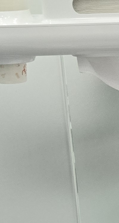 어금니 임플란트 안하면 후회하게 되는걸까 관련 이미지 16