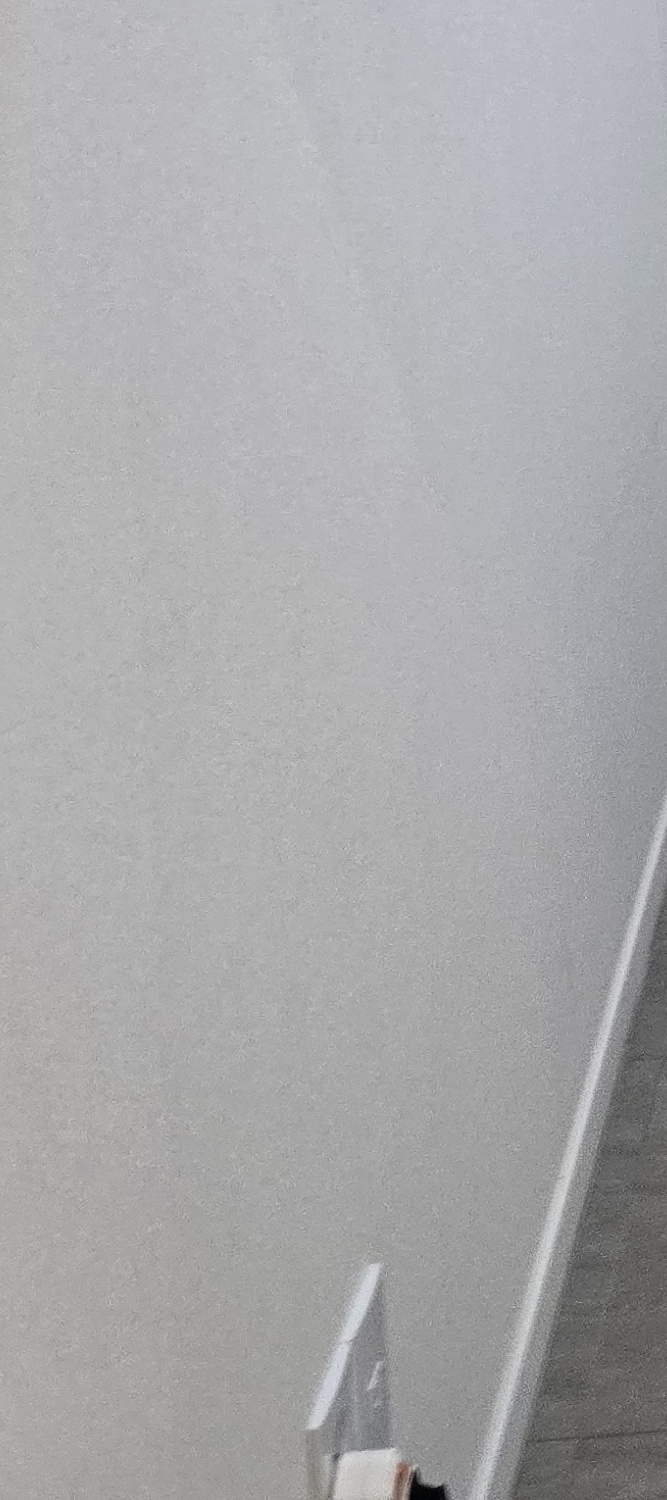 금 크라운 수명 몇년이나 지속될까요 관련 이미지 30
