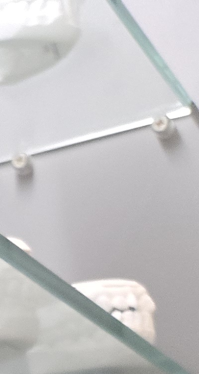 앞니 틀어짐 부분교정 얼마나 걸릴까 관련 이미지 19