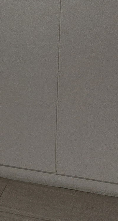 앞니 틀어짐 교정 조화롭게 마무리하려면 관련 이미지 37