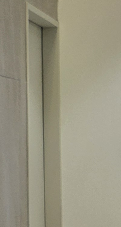 앞니 신경치료 크라운 까지 해야할 상황이라면 관련 이미지 39