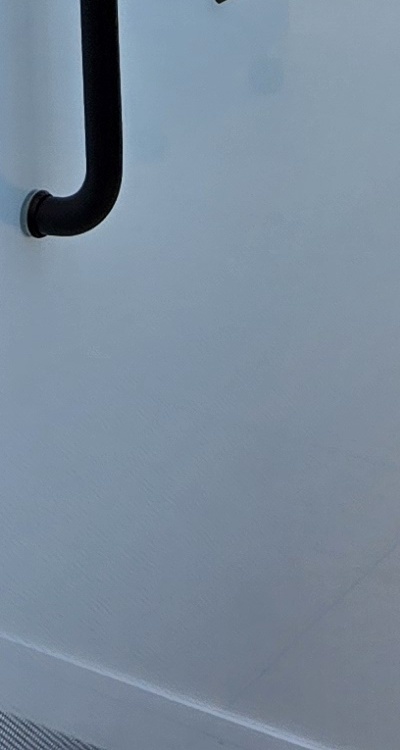 아말감 교체 레진 인레이 어떻게 대처하면 될까 관련 이미지 46