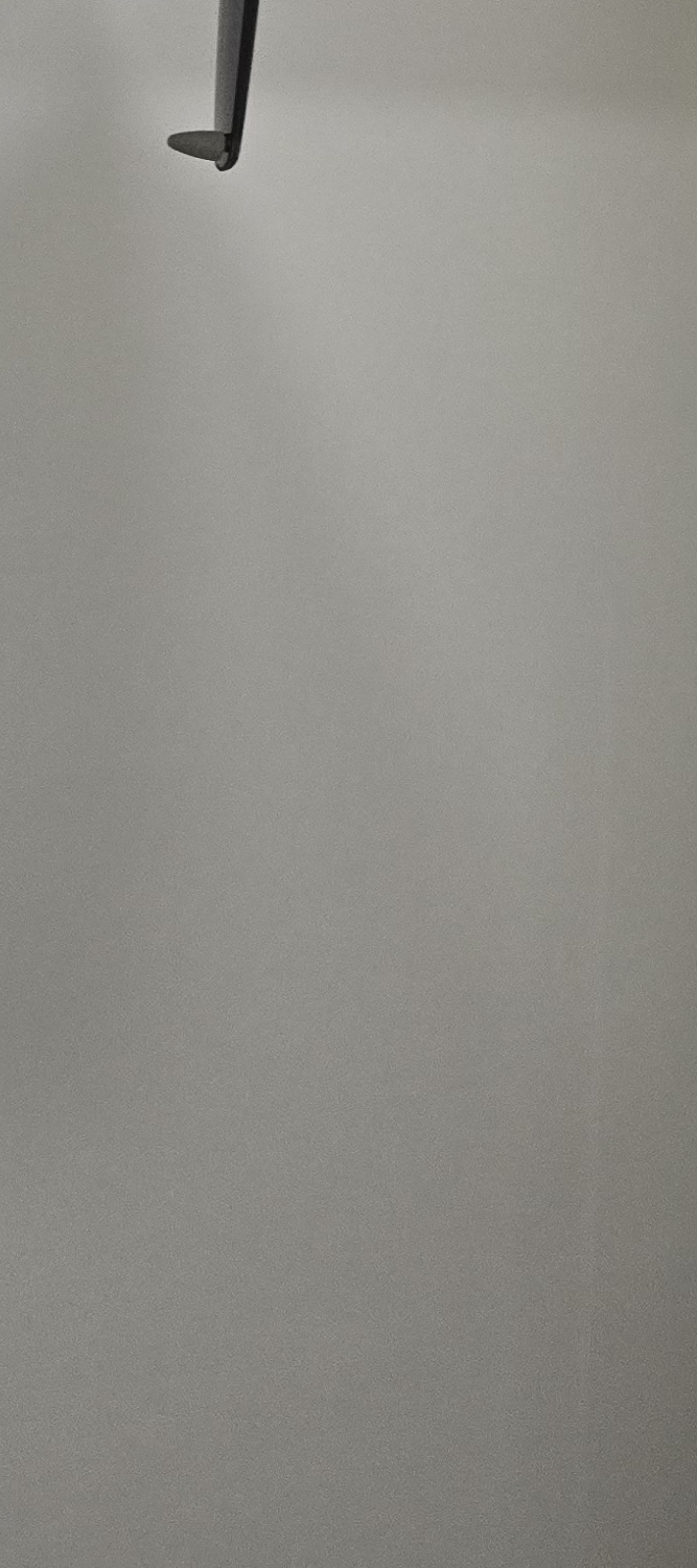 벌어진 앞니 교정 체계적으로 대비하려면 관련 이미지 32