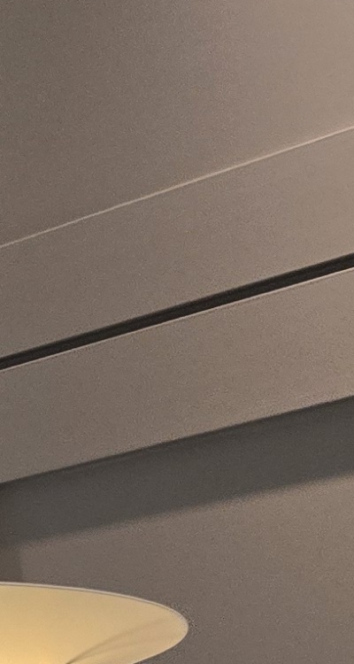 인레이 치료 후 통증 자꾸 심해지는데 괜찮은걸까 관련 이미지 29