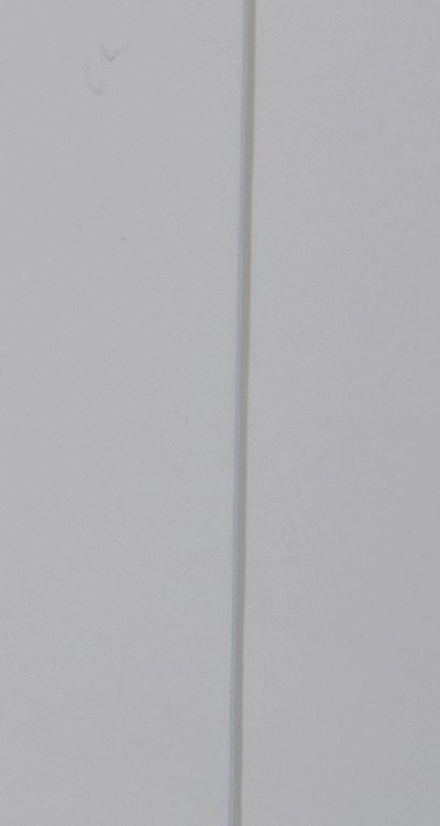 앞니 부분 교정 간단하니까 좋은건가요 관련 이미지 30