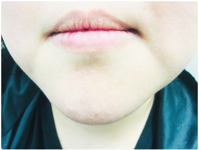 피부탄력 제대로 관리하자 관련 이미지 7