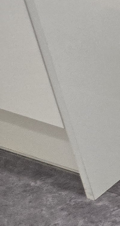 치아 사이 벌어짐 심해지는 이유부터 알아보면 관련 이미지 19