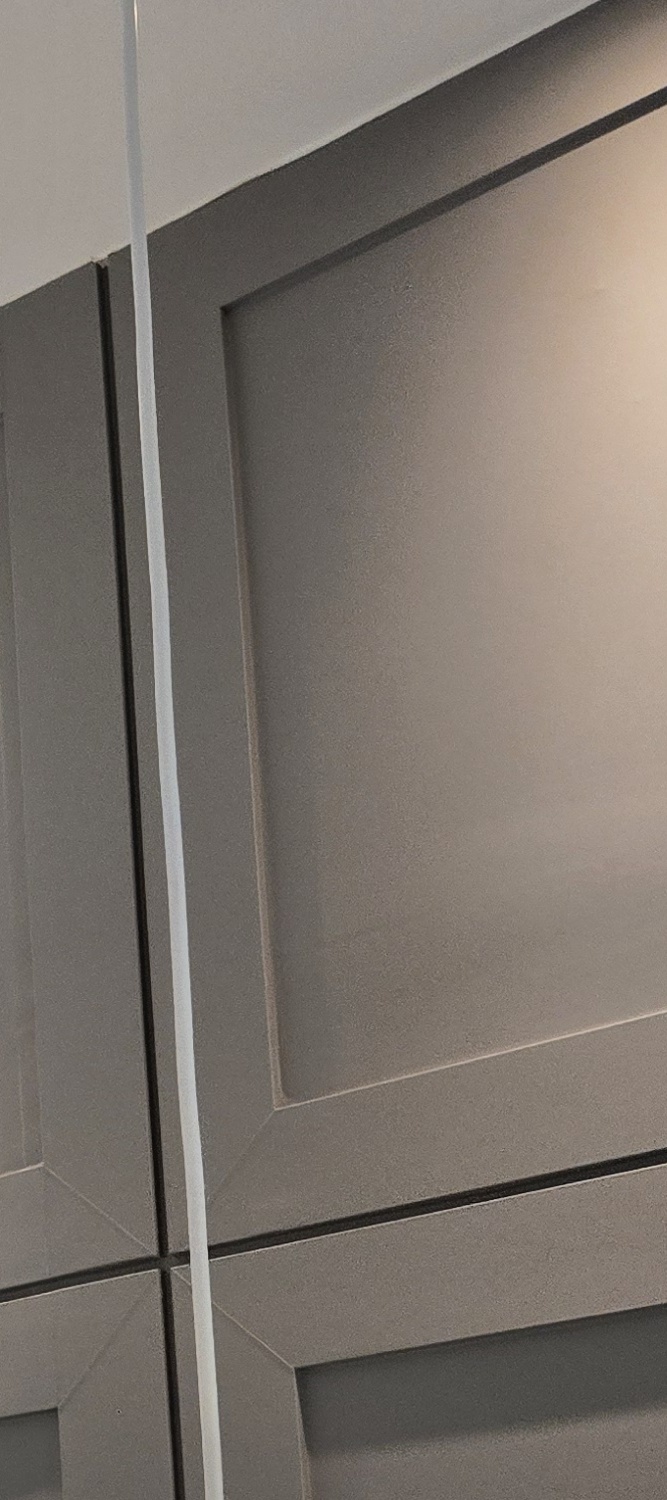 어금니 임플란트 뼈이식 이럴때 해당됩니다 관련 이미지 25