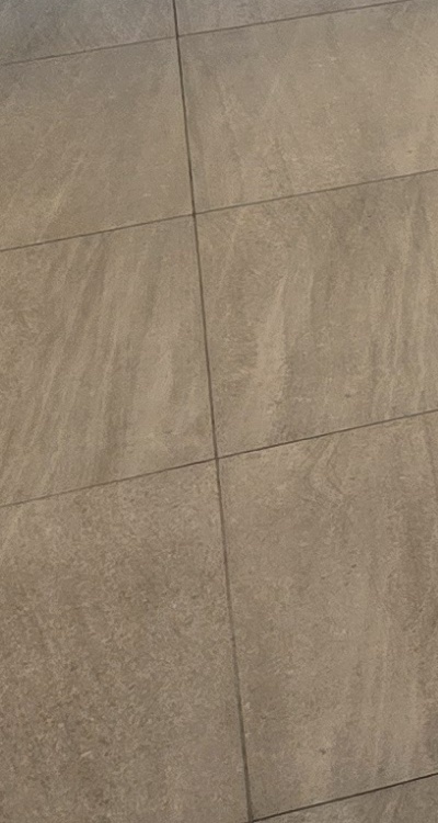 앞니 부분 교정 간단하니까 좋은건가요 관련 이미지 45