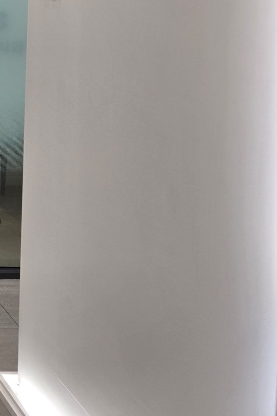 어금니 임플란트 과정 제대로 이해하려면 관련 이미지 30