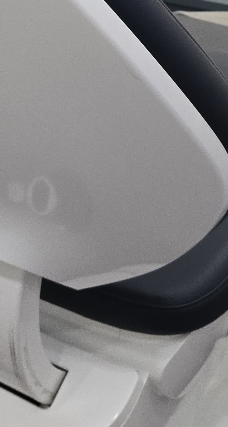 어금니 임플란트 뼈이식 이럴때 해당됩니다 관련 이미지 18