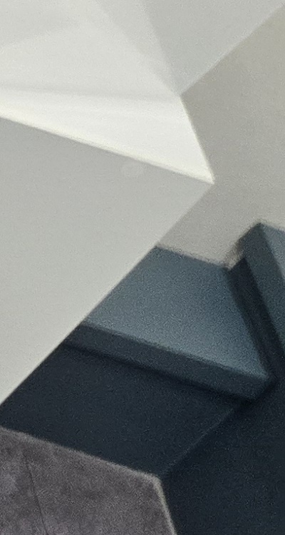 치아 사이 벌어짐 심해지는 이유부터 알아보면 관련 이미지 38