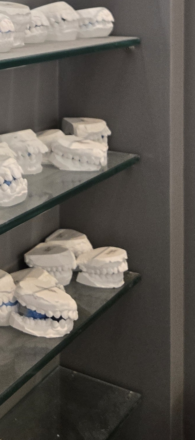 돌출 앞니 교정 이렇게 준비하세요 관련 이미지 32