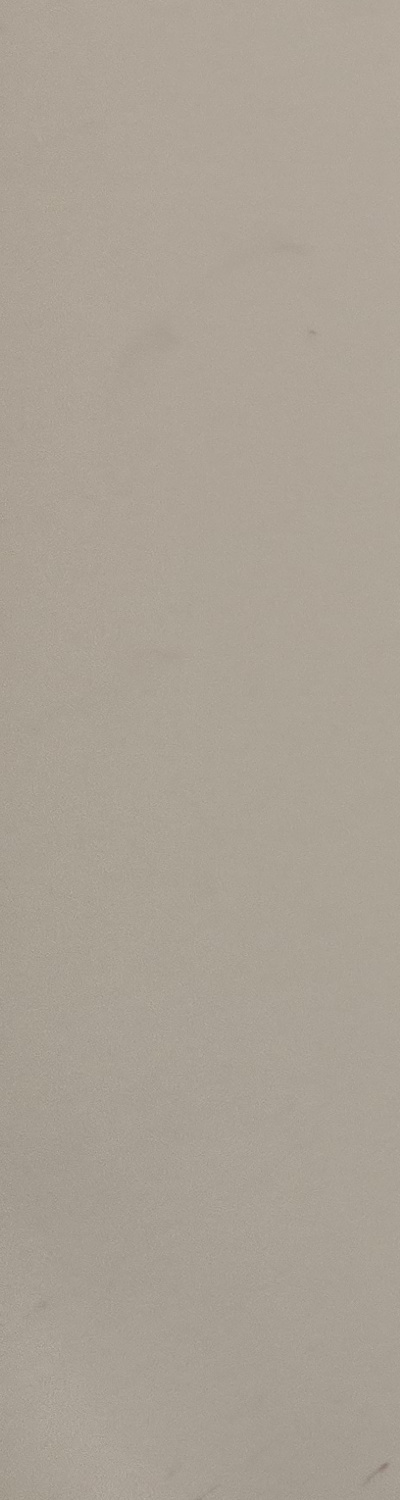 어금니 없으면 얼굴 발음에 어느정도나 안좋을까 관련 이미지 25