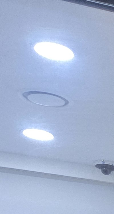 사랑니 발치 후 충치 치료 둘다 준비하려면 관련 이미지 12