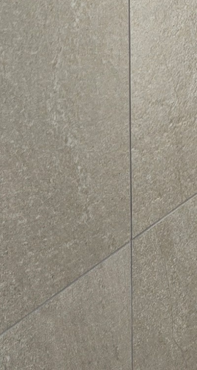 임플란트의 장점 할까 말까 고민이신 분들을 위한 정리 관련 이미지 43