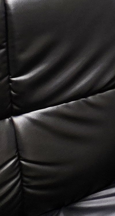 돌출입 팔자주름 교정 얼마나 바뀔까요 관련 이미지 43