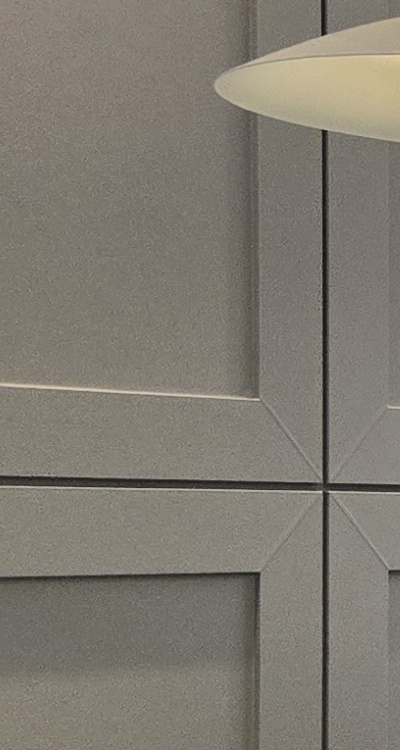 아래 사랑니 발치 통증 미리 알고 대처하려면 관련 이미지 21