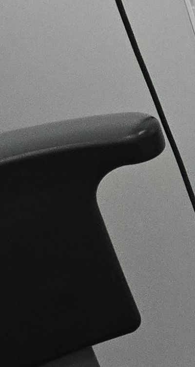 어금니 임플란트 안하면 후회하게 되는걸까 관련 이미지 23