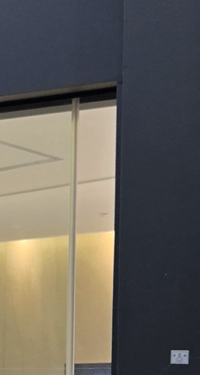 치아 발치 후 임플란트 언제부터 준비할까 관련 이미지 28