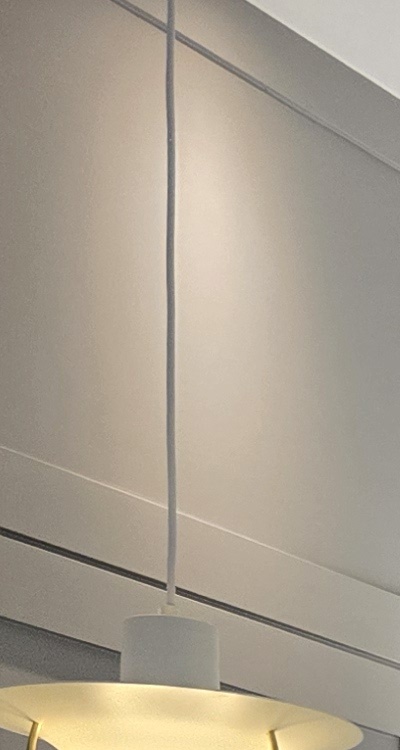 아래 사랑니 발치 통증 미리 알고 대처하려면 관련 이미지 12